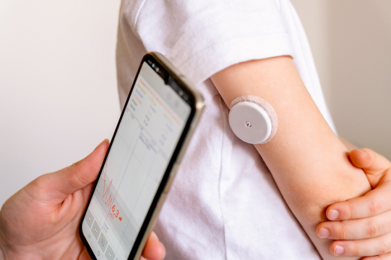 Sensor de glucosa colocado en el brazo para controlar la diabetes en tiempo real