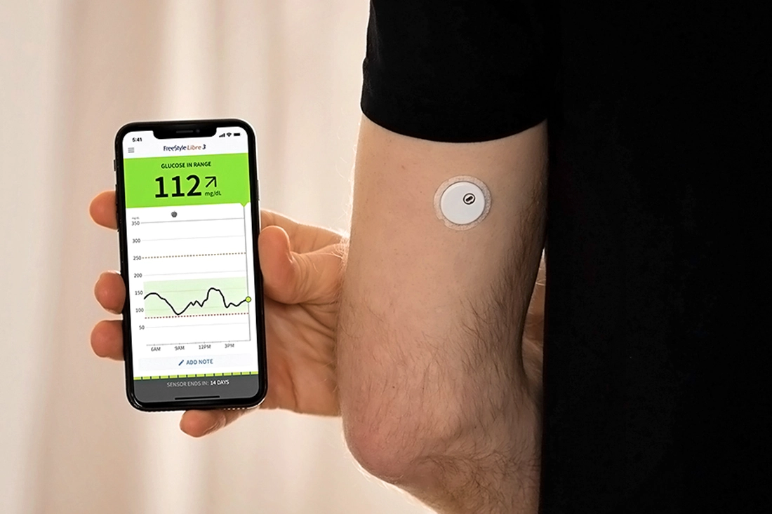 Sensor de control glucémico FreeStyle LIbre 3 insertado en el brazo. Junto a un teléfono móvil con gráficas de la glucosa.