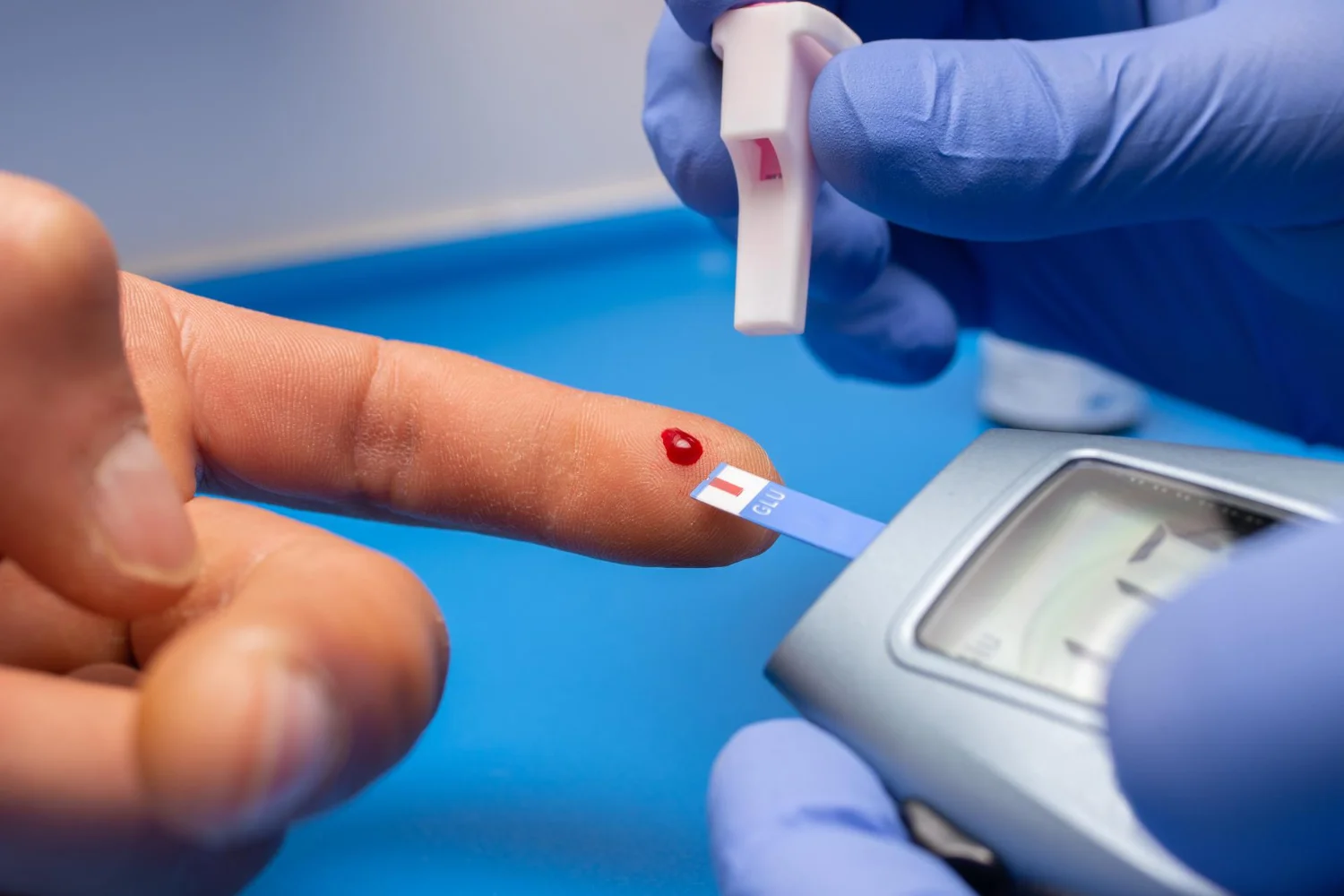 Profesional sanitario con guantes realizando una prueba capilar de glucosa en el dedo a un paciente