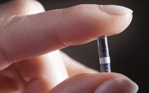 Imagen primer plano implante sensor de glucosa para la monitorización continua de glucosa en sangre.